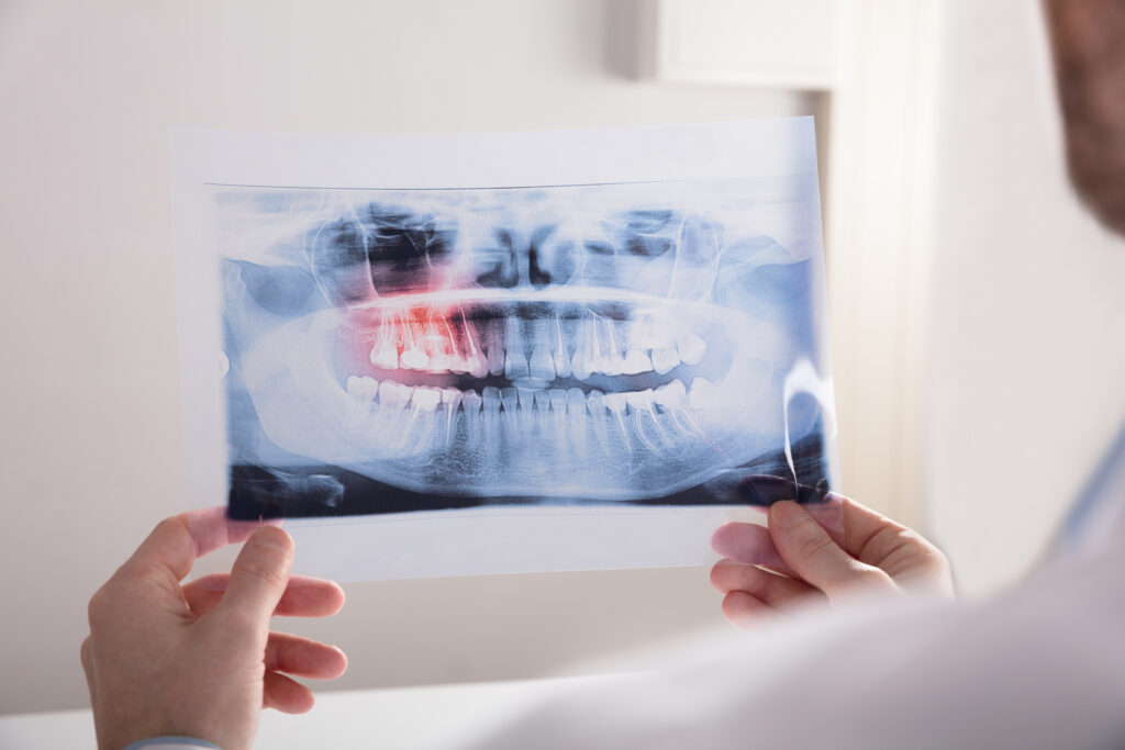 Close-up Of A Doctor's Hand Holding Teeth X-ray