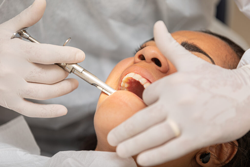 Young woman being seen in a dentist's office. Concept of toothache, wisdom tooth extraction, anesthesia, problems with caries or gums. Oral health care. Dentist day.