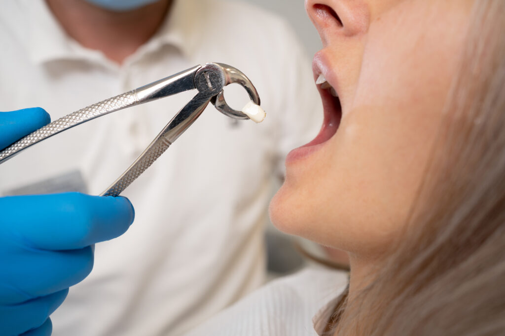 close-up of forceps for extraction of teeth and a tooth in them. The concept of going to the dentist. copy space.